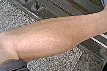 ��΢���۲�