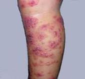 ��ʶ����ʪ�������