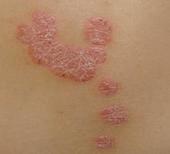 ����Ƥ��