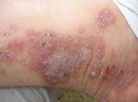 ����ʪ���ͼƬ