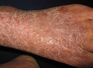 ����ʪ���ͼƬ