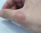 Ԥ��ţƤѢ�����ķ���