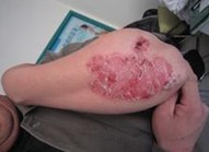 ����ţƤѢ��ԭ��