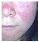 �Ӵ���Ƥ�����Ƶ�ע������