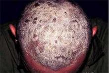 ����ͷ��ţƤѢ��ô����