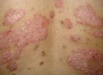 Ԥ��ţƤѢ���������룺ע�⻤��