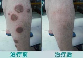 ������ţƤѢ�����ķ���