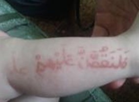 ����ţƤѢ���κ���