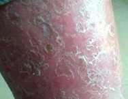 ţƤѢ��ͶҽΣ����