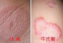 ��Ѣ��ţƤѢ�Ĳ��