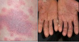 ���컻���·����½Ӵ���Ƥ��