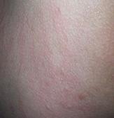 ʲô������������Ƥ�ף�