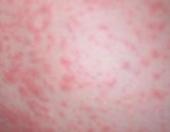 ����Ƥ��������Ƥ�׵Ĳ�ͬ