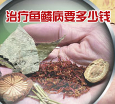 �������۲�Ҫ����Ǯ