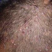 ��Ⱦ���ĳ�����Ů��С�Ļ��Ӵ���Ƥ��