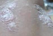 ����ţƤѢ������ҩ��ĸ�����