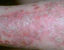 ��������ţƤѢ��ô��