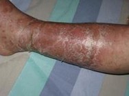 ��м������ʧ����ô��