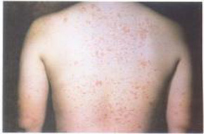 ����ţƤѢ�Ե���Ϊ��