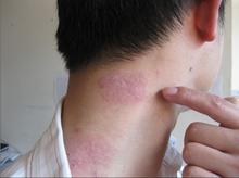 ��ţƤѢ���ע������