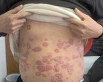 �ڷ���������ţƤѢ����Ҫ��������