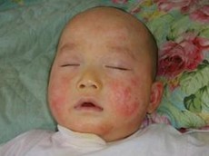 Ӥ��ʪ��������