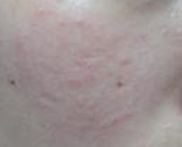 ������Ƥ�׵���ʳ����