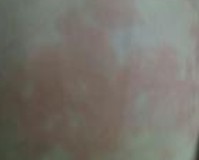 ������Ƥ�׶���ܺ�