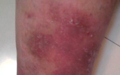 ��������ţƤѢ��ȱ��