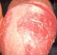 ʲô������ţƤѢ