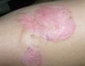 ����ţƤѢ����ҽԺ