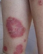 ������ҽ����ţƤѢҽԺ