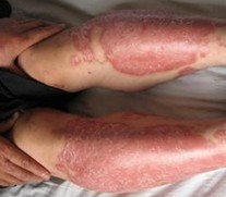 ����������ţƤѢҽԺ