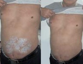 �����ļ�ҽԺţƤѢ���