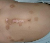 ����Ƥ��Ѣ���ļ�ҽԺ��