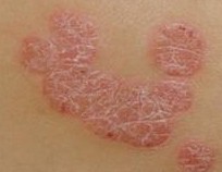 ����ţƤѢ������ѯҽ��