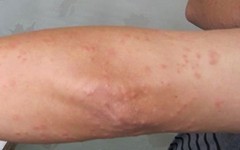 �����ļ�ҽԺ��ţƤѢ��