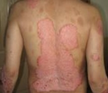 ����ר��ţƤѢҽԺ������