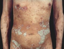 ��������ţƤѢ�ĸ�ҽԺ��