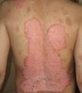 ��������ţƤѢ�����