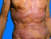 ����ţƤѢ�������������