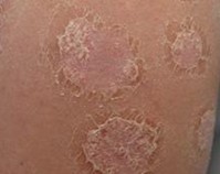 ����ţƤѢ��ô�������