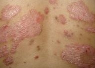 ������ţƤѢ�����������