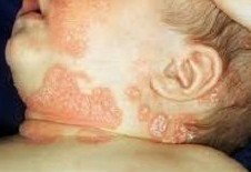 ����ƤѢ���ļ�ҽԺ��