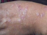 �����ļ�ҽԺ��ţƤѢ