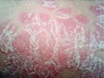 ��������ţƤѢ����Ǯ