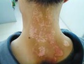 �����Ŀ�ţƤѢ�õ�ҽԺ