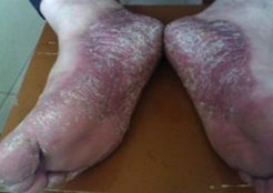 ���ڿ�ţƤѢ��õ�ҽԺ