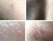 ���۲�֢״���ͱ���