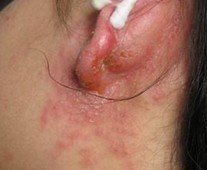 ��������ʪ����ô��